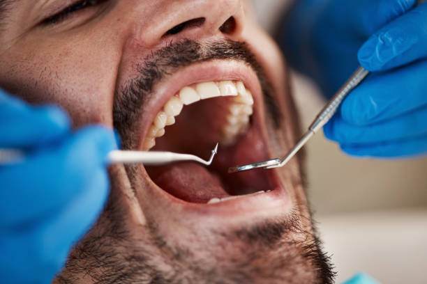 Best Emergency Treatment for Dental Infections or Abscesses in Trenton, IL