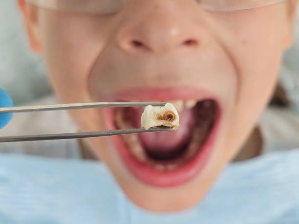Best After-Hours Dental Trauma Care in Trenton, IL