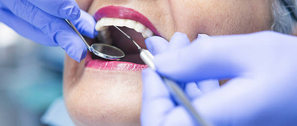 Best Emergency Dental Care for Broken or Chipped Teeth in Trenton, IL