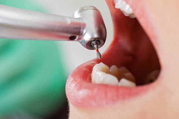 Best Weekend Emergency Dentist in Trenton, IL